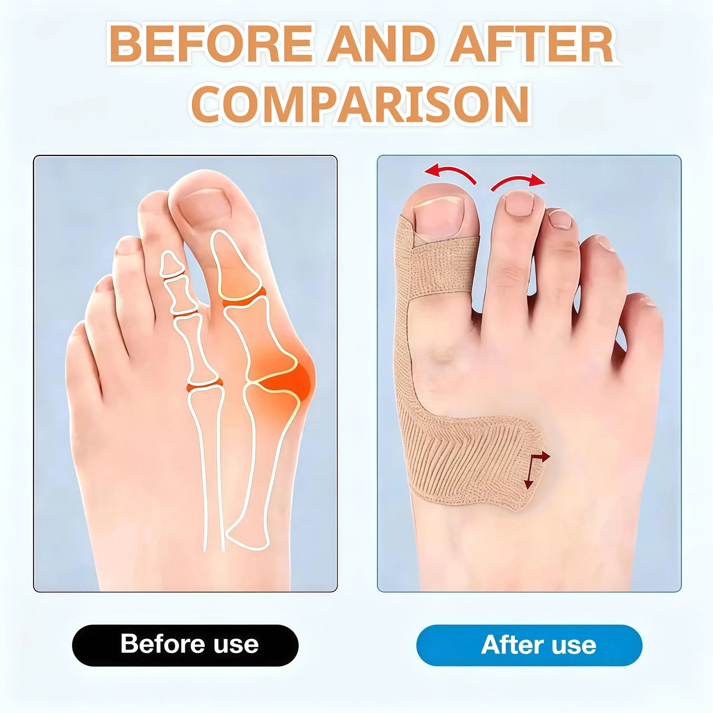 Precut Bunion Corrector Tape – Big Toe Support & Pain Relief