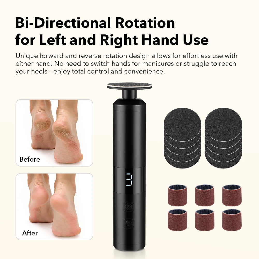 Electric Callus Remover – 6-Speed USB-C Rechargeable Pedicure Tool