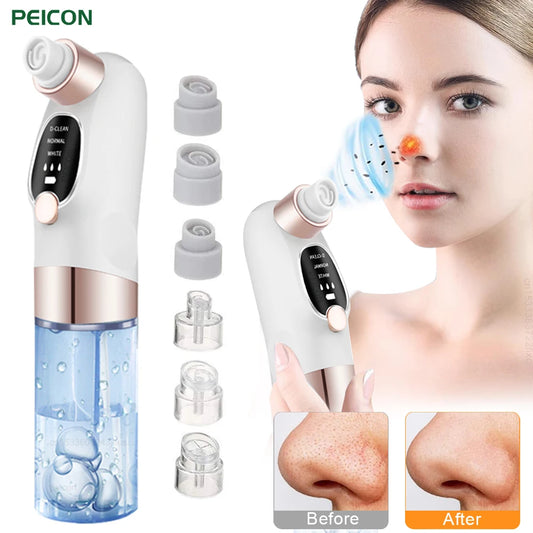 Blackhead Remover Pore Vacuum - Facial Cleansing Device