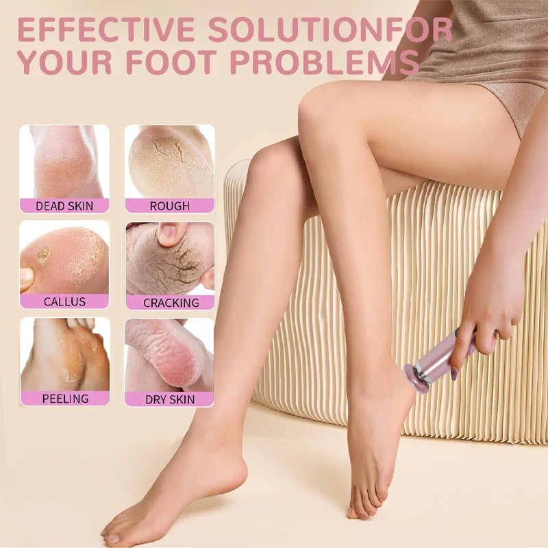2-in-1 Electric Callus Remover – Painless Foot & Hand Care Tool