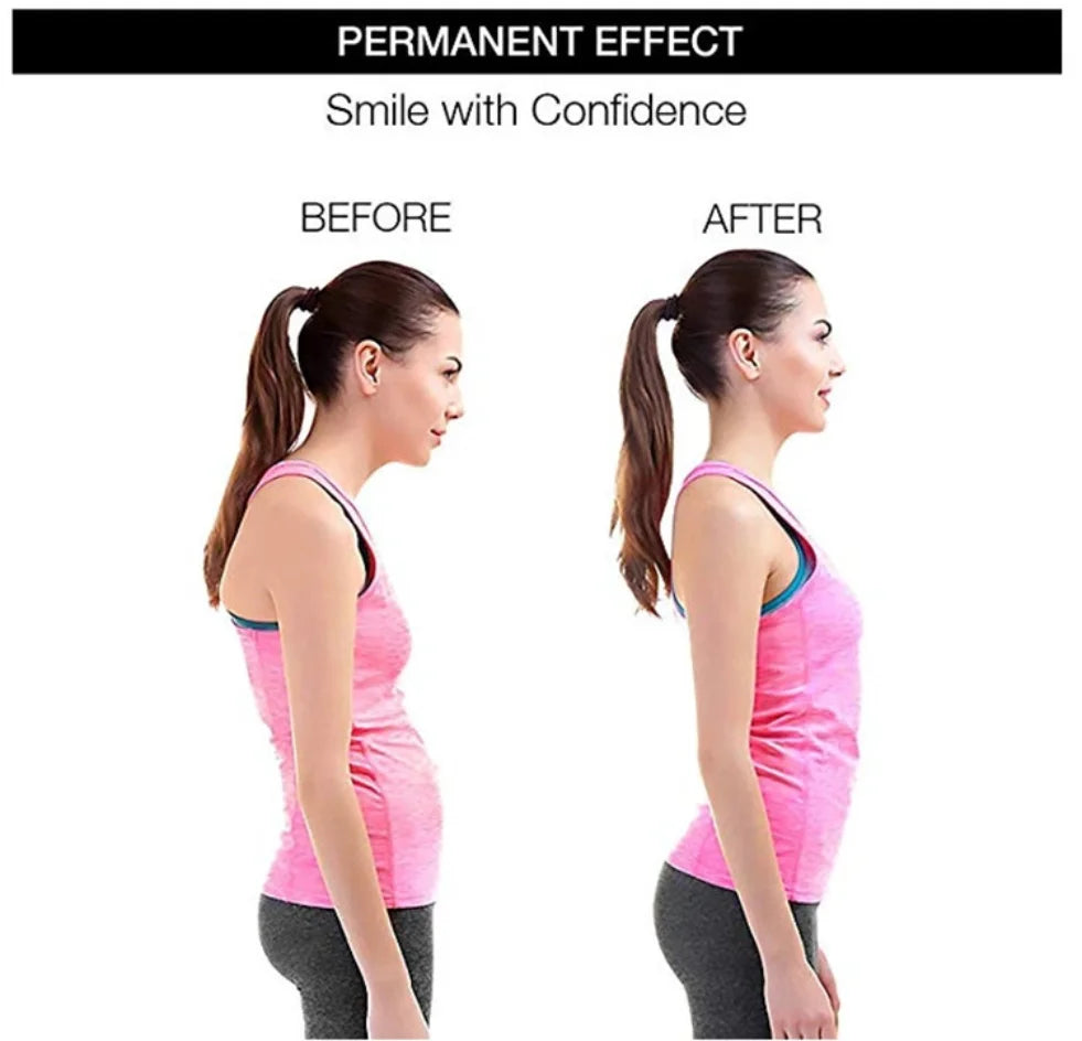Adjustable Posture Corrector Belt – Back & Spine Support