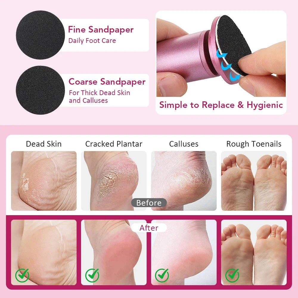 Electric Foot File – 360° Rotation USB Callus Remover with 20 Sandpaper Discs